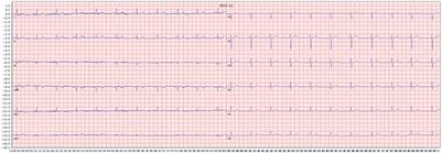 Image based deep learning in 12-lead ECG diagnosis